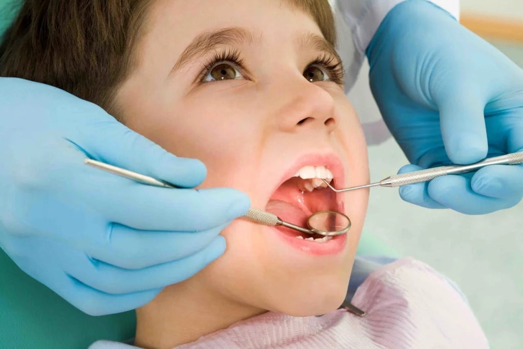 Management of Cavities in Children