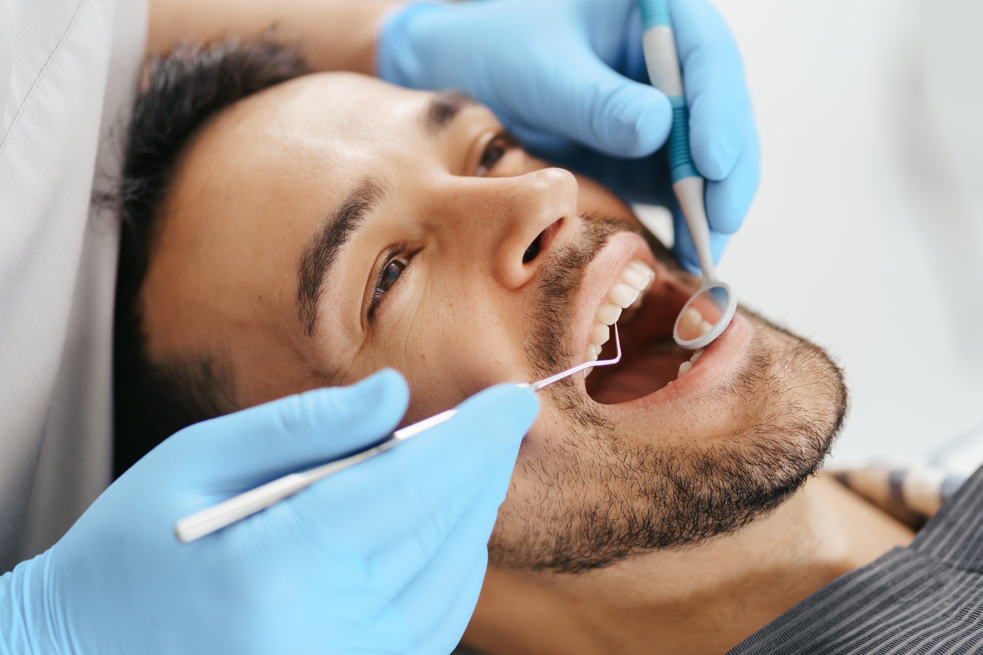 Root Canal Treatment (RCT)